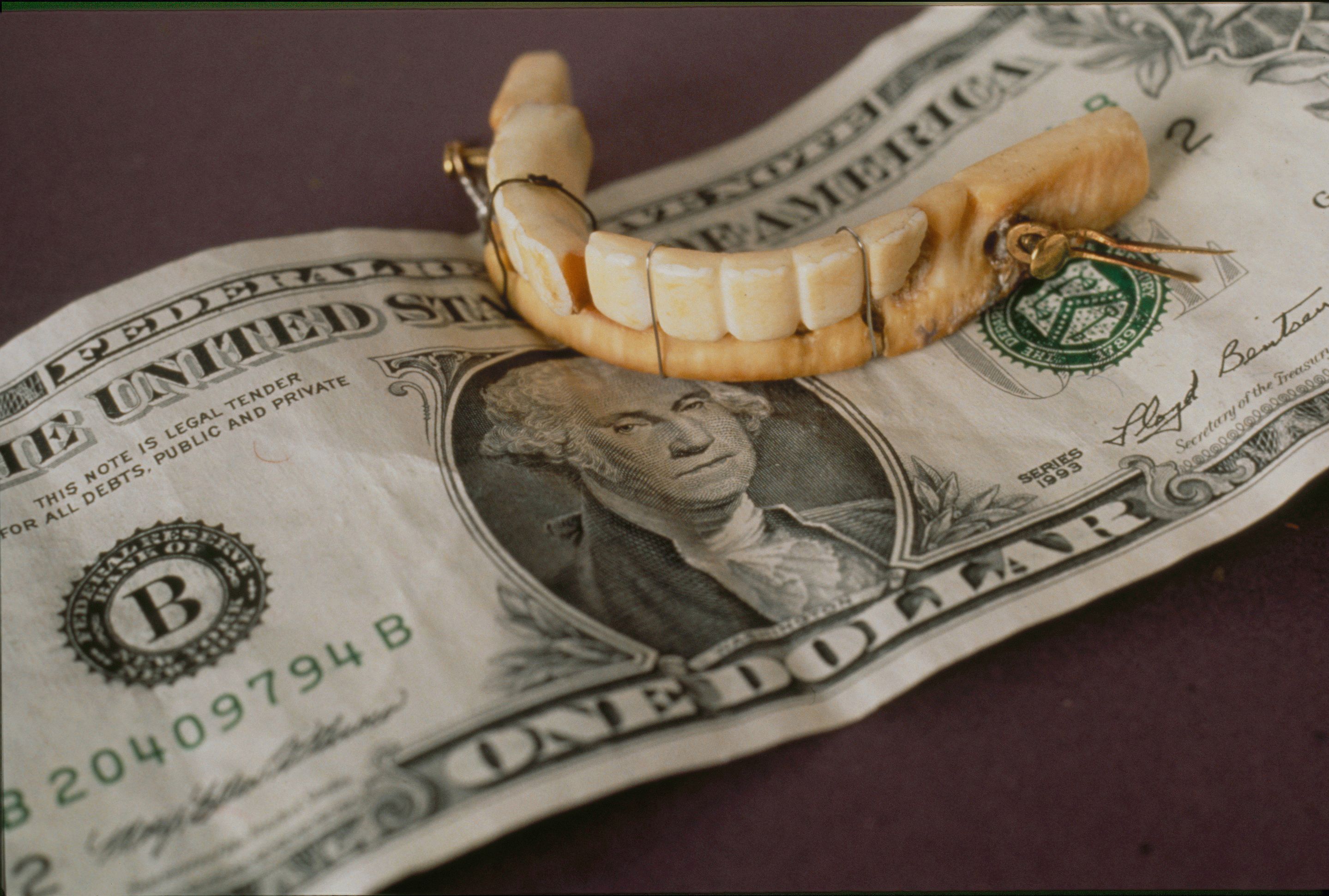 Nangungunang 5 pinakamahusay na produkto sa pag-aayos ng pustiso noong 2025