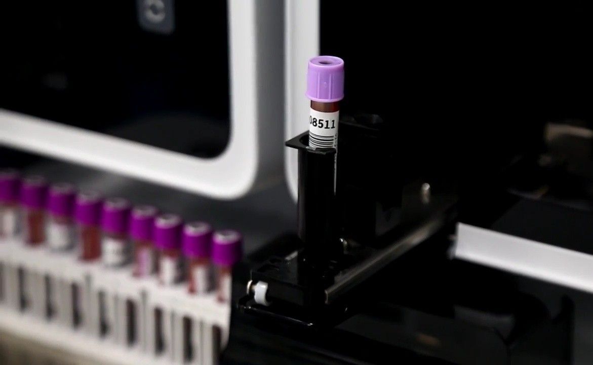 Revisión de los mejores laboratorios de análisis médicos en Omsk en 2025