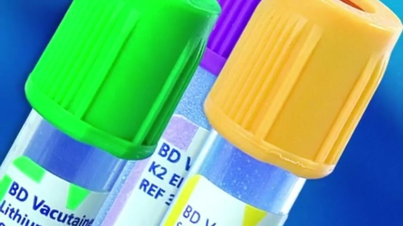 2025 میں کریمیا کے تجزیہ کے لیے بہترین طبی لیبارٹریز