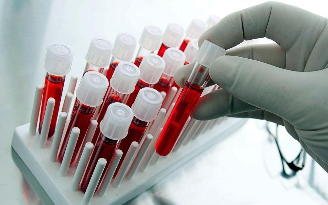 I migliori laboratori di analisi mediche a Voronezh nel 2025