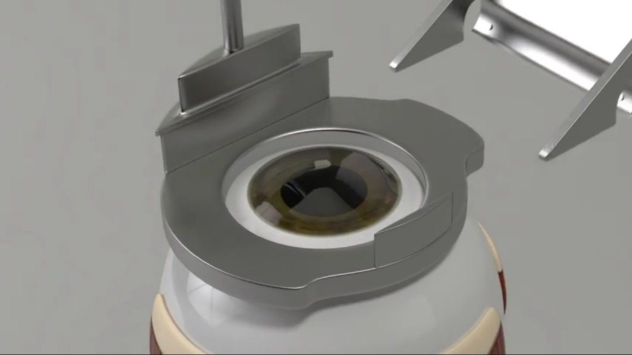 Ulasan klinik oftalmologi terbaik di Kazan pada tahun 2025