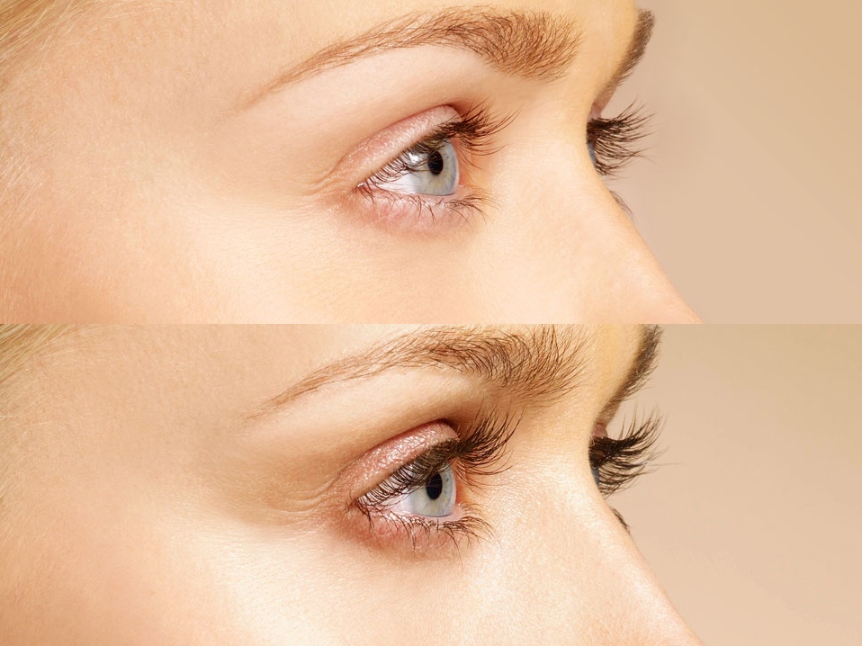 Peringkat produk penumbuh bulu mata terbaik untuk 2025