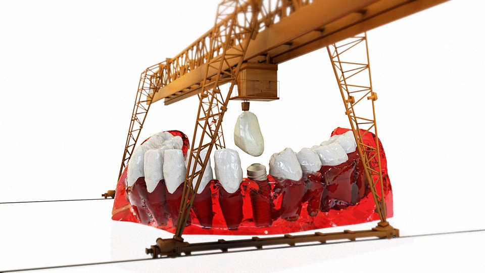 Peringkat klinik implan gigi terbaik di Novosibirsk untuk tahun 2025