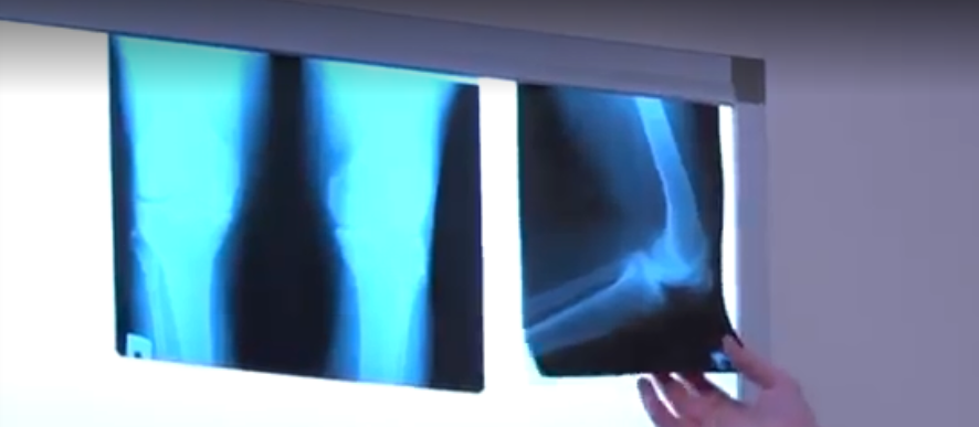 2025 کے لیے ماسکو میں بہترین ٹراما کلینکس کی درجہ بندی