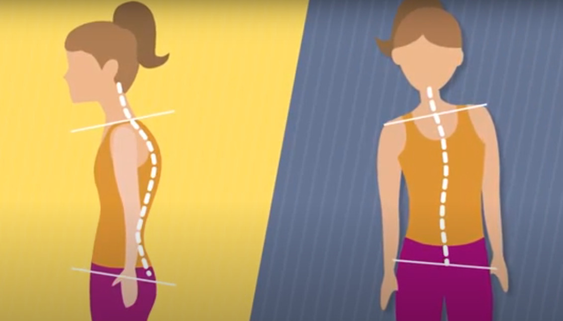 Valutazione dei migliori trainer posturali per il 2025