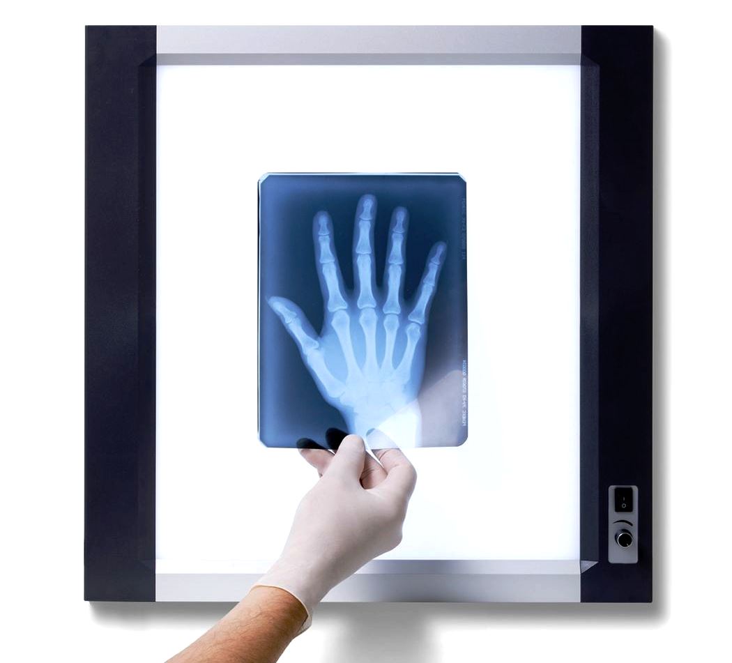 Peringkat negatoscopes terbaik untuk 2025