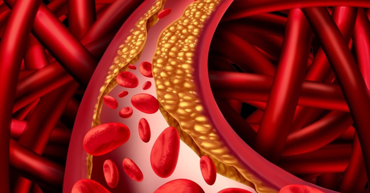 2025 کے لیے بہترین کولیسٹرول گولیوں کی درجہ بندی