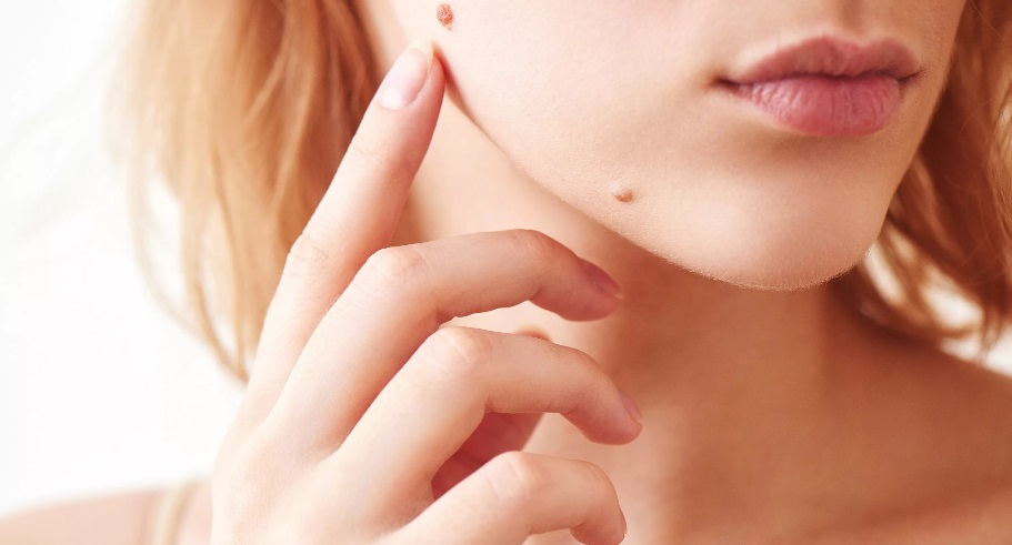 2025 کے لیے پیپیلوما کے بہترین علاج کی درجہ بندی