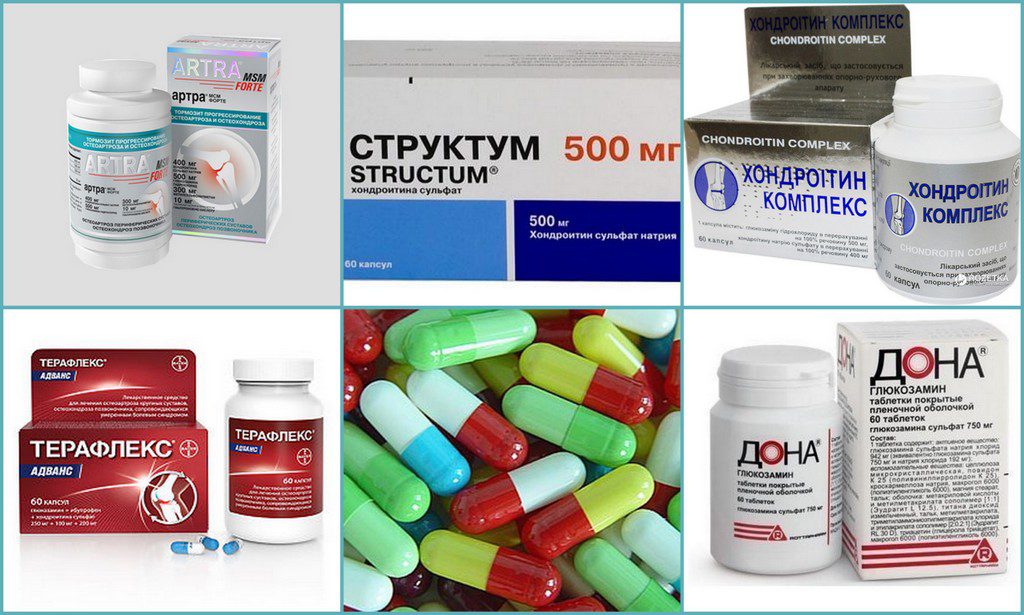 דירוג מגני הכונדרופוטקטורים הטובים ביותר למפרקים לשנת 2025