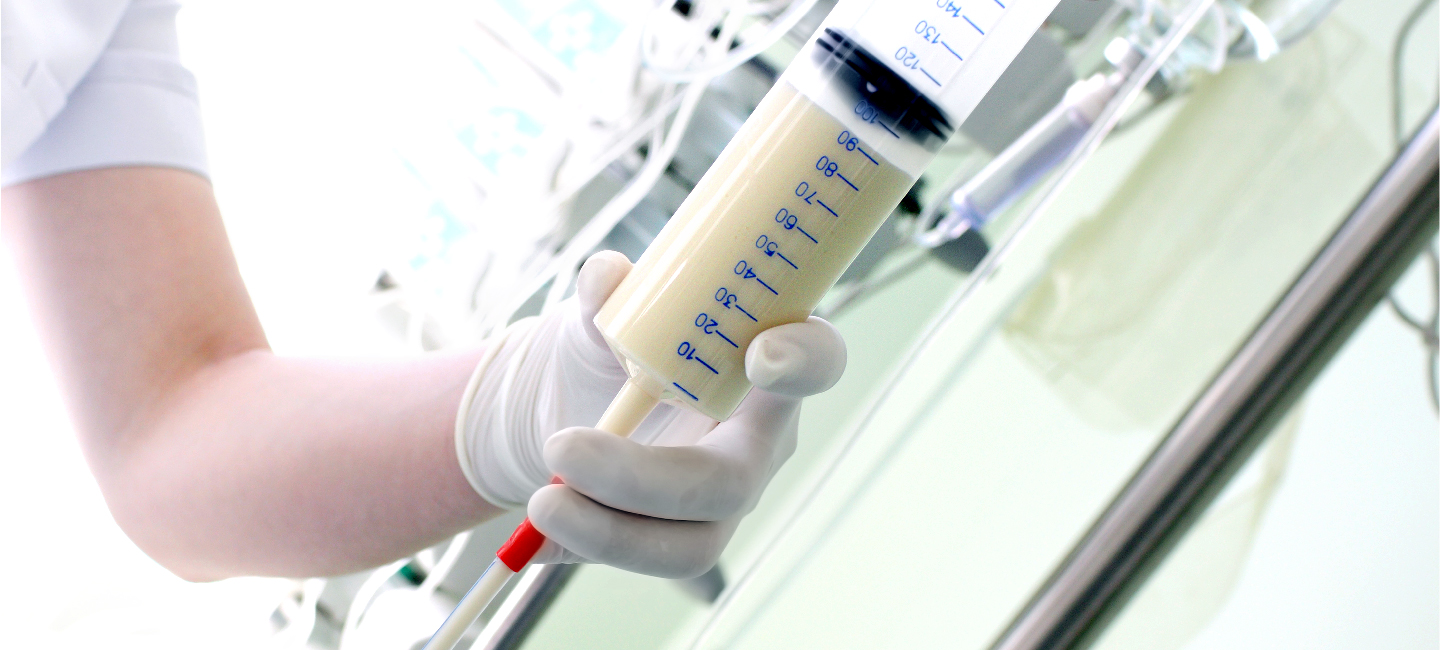 2025 کے لیے داخلی غذائیت کے لیے بہترین سرنجوں کی درجہ بندی