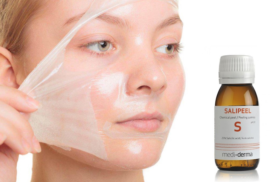 2025 کے لیے بہترین تیزاب کے چھلکے کی درجہ بندی